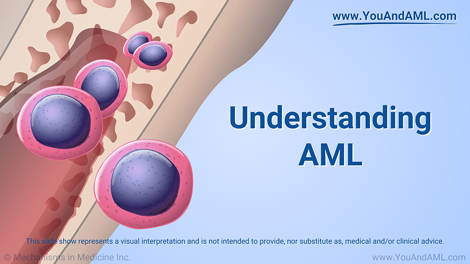 Slide Show - Understanding AML
