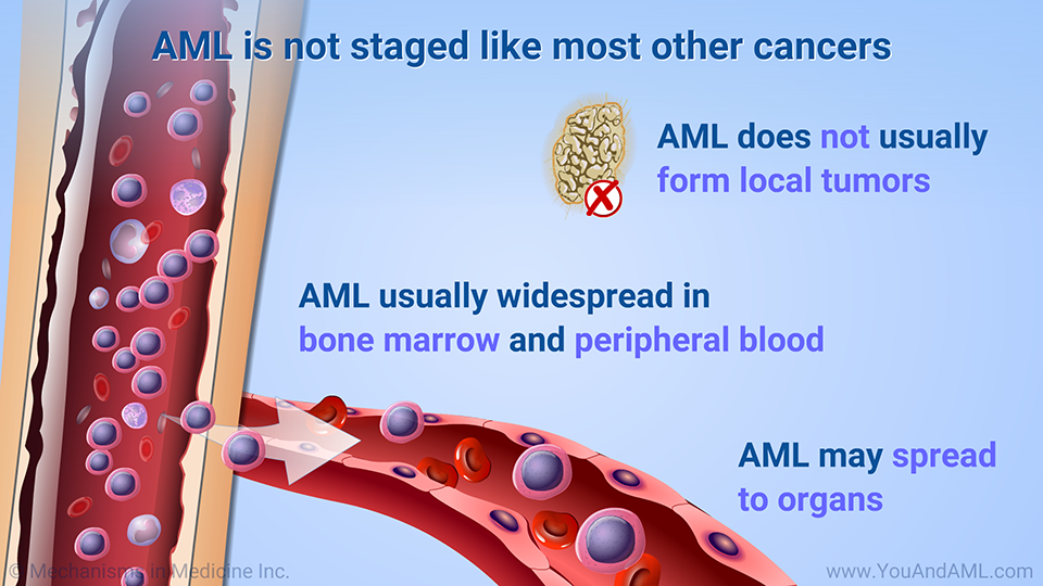 AML is not staged like most other cancers