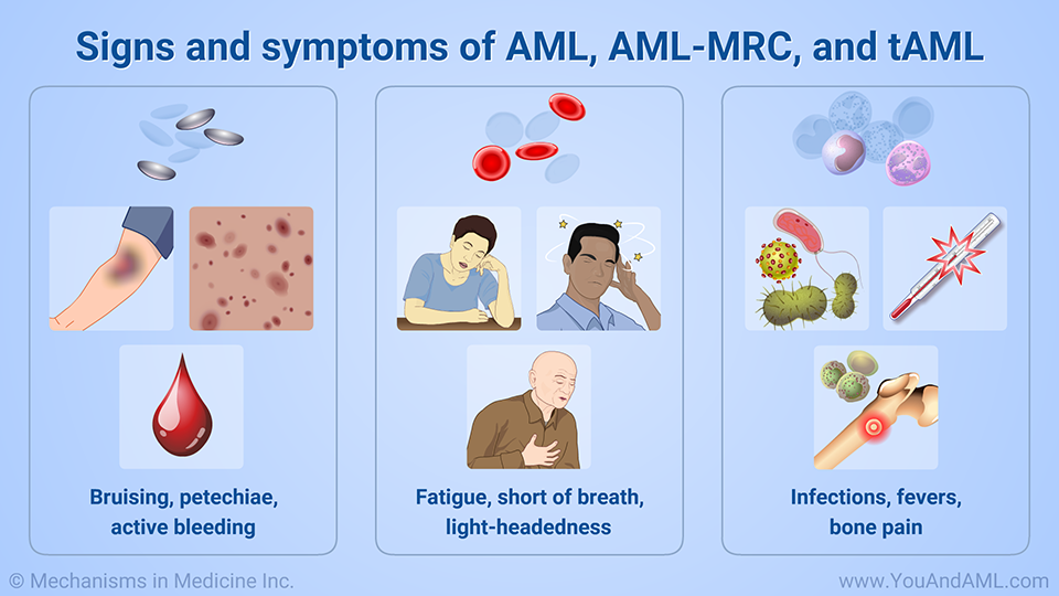 Signs and symptoms of AML, AML-MRC, and tAML