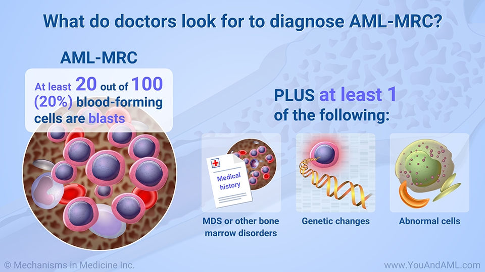 What do doctors look for to diagnose AML-MRC?