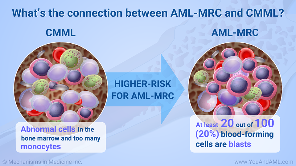 What’s the connection between AML-MRC and CMML?