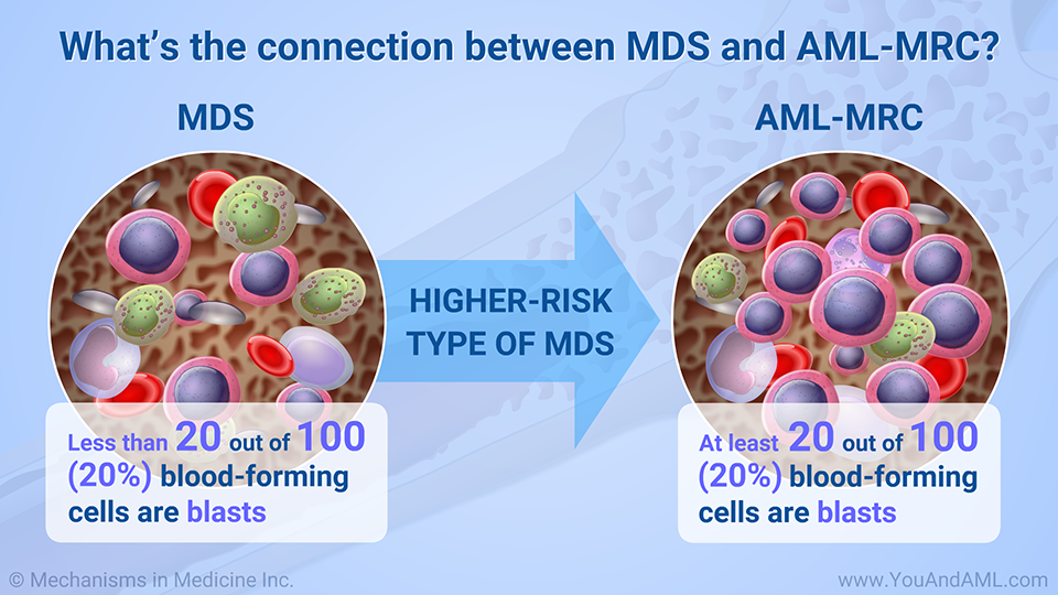 What’s the connection between MDS and AML-MRC?