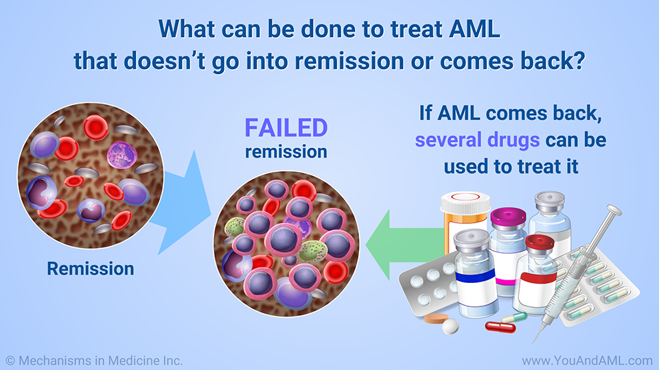 What can be done to treat AML that doesn’t go into remission or comes back?