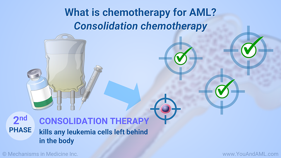 What is chemotherapy for AML? Consolidation chemotherapy