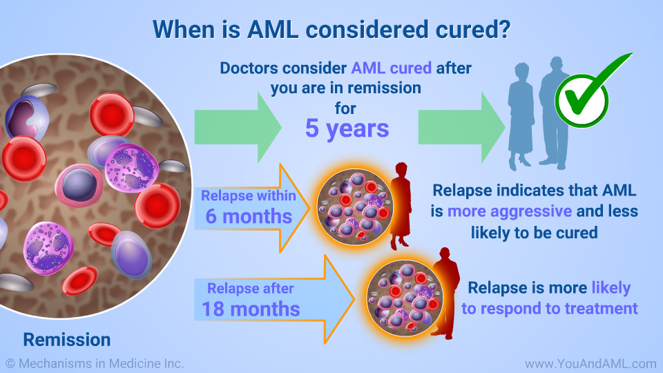 When is AML considered cured?