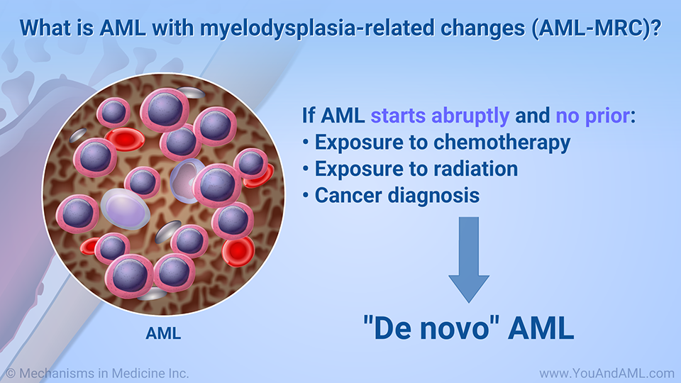 What is AML with myelodysplasia-related changes (AML-MRC)?
