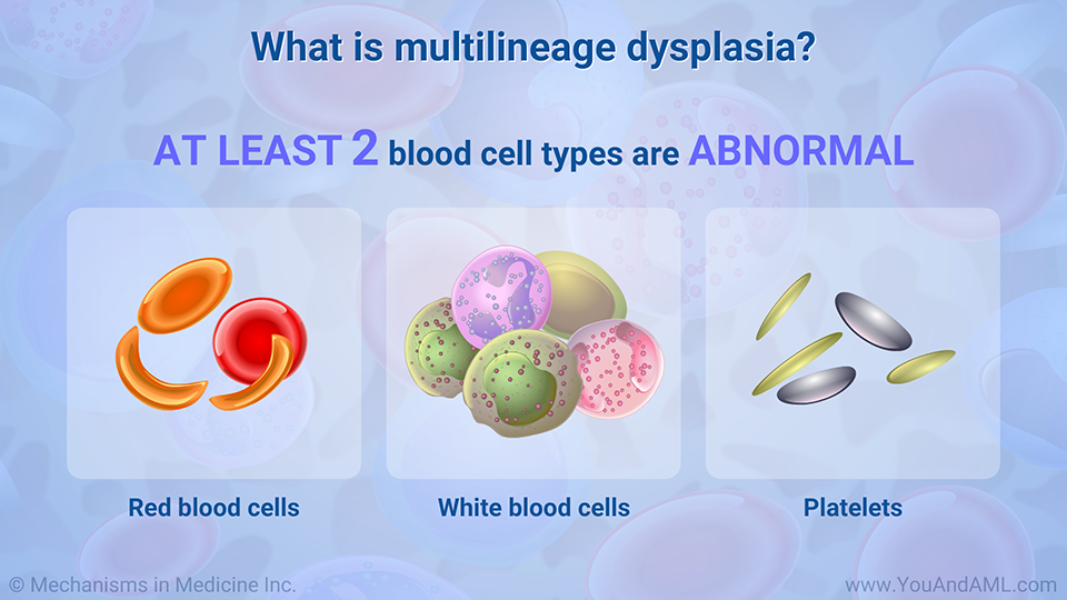 What is multilineage dysplasia?