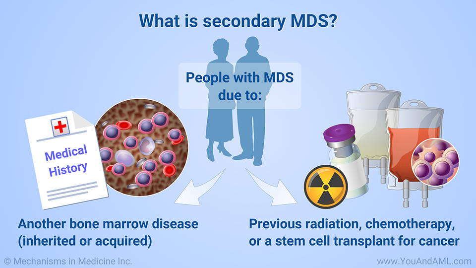 What is secondary MDS?